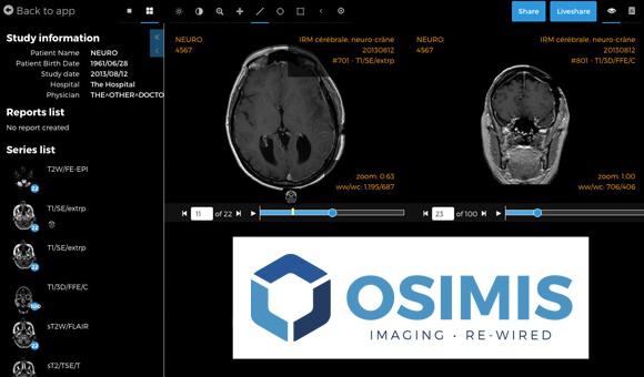 La start-up liégeoise Osimi est active dans les solutions logicielles d’imagerie médicale